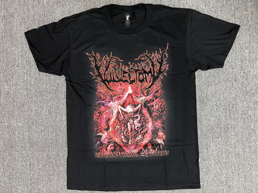 Vulvectomy - Aberrant Vaginal Gestation - T-Shirt