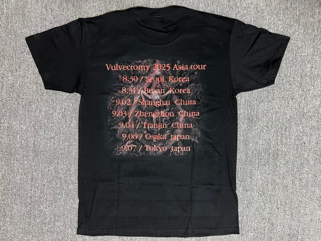 Vulvectomy - Aberrant Vaginal Gestation - T-Shirt