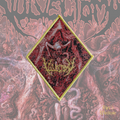 Vulvectomy - Aberrant Vaginal Gestation - Patch