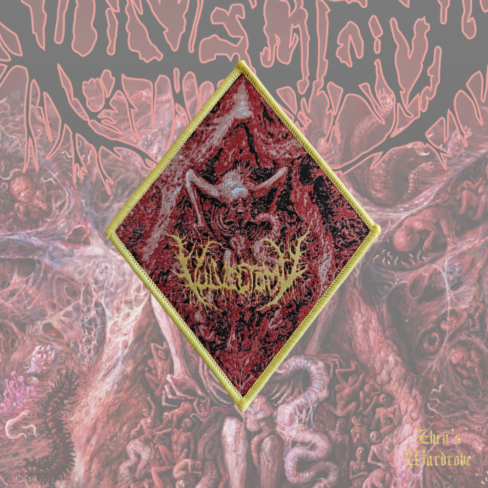 Vulvectomy - Aberrant Vaginal Gestation - Patch