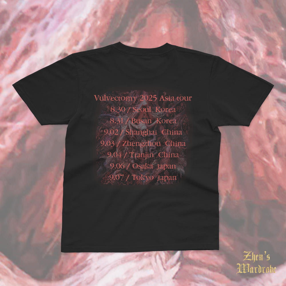 Vulvectomy - Aberrant Vaginal Gestation - T-Shirt