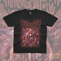 Vulvectomy - Aberrant Vaginal Gestation - T-Shirt